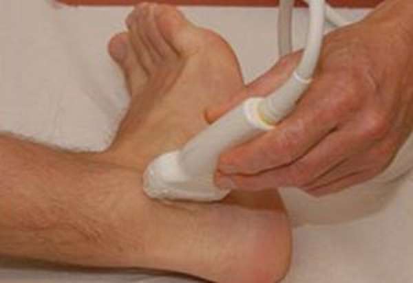 Виды и лечение гигромы на ноге